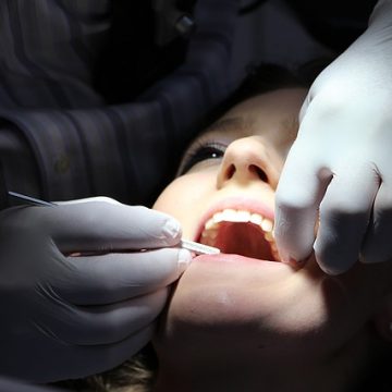 Odontología Conservadora: qué es y en qué consiste