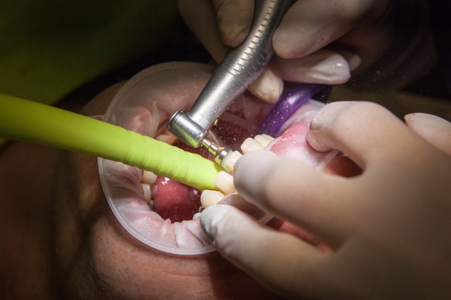 ¿Qué es una endodoncia y cuándo se aplica?